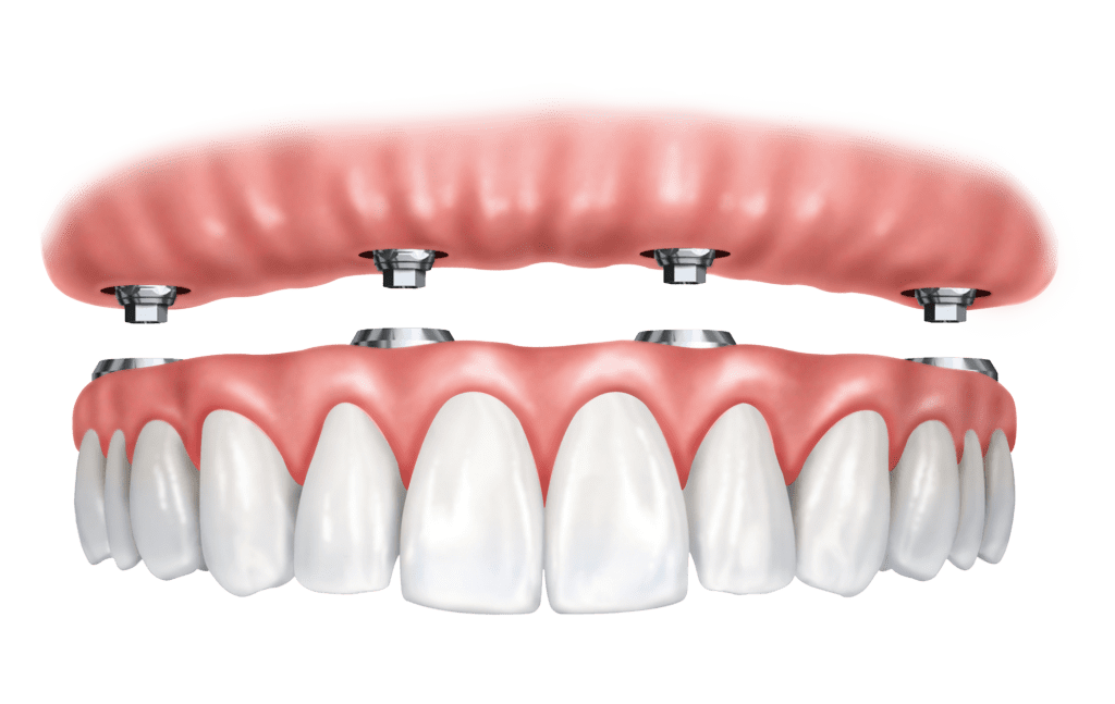 protocolo dentário na Allegra Odontologia