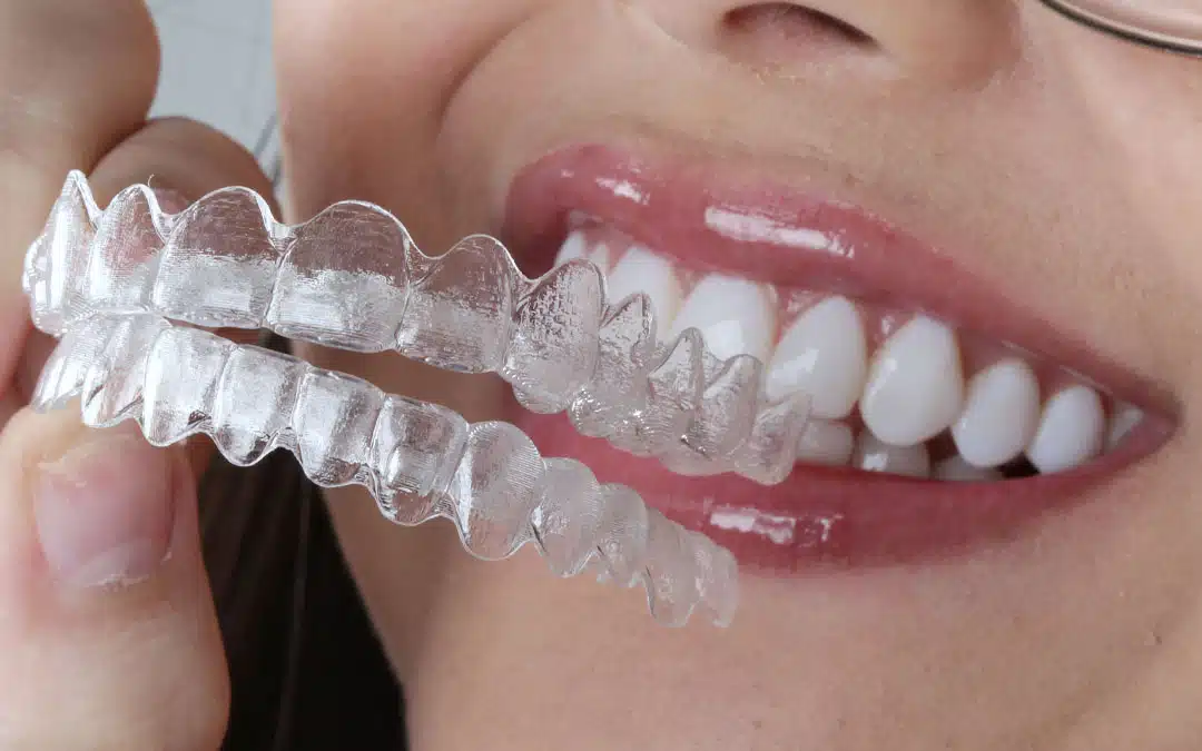 invisalign na allegra