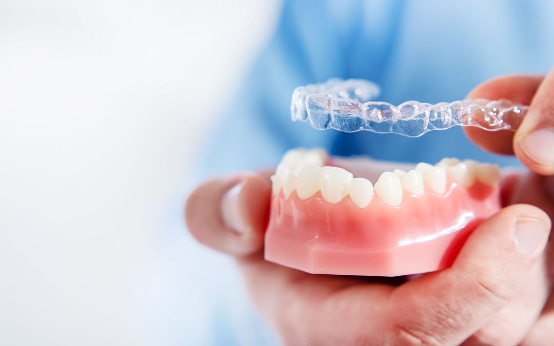 A Melhor Ortodontia Na Zona Leste na Allegra