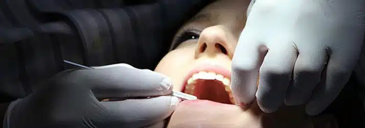 Benefícios das coroas dentarias de porcelana na Allegra