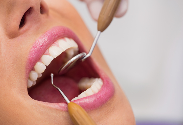 Facetas de Resina Estragam os Dentes?