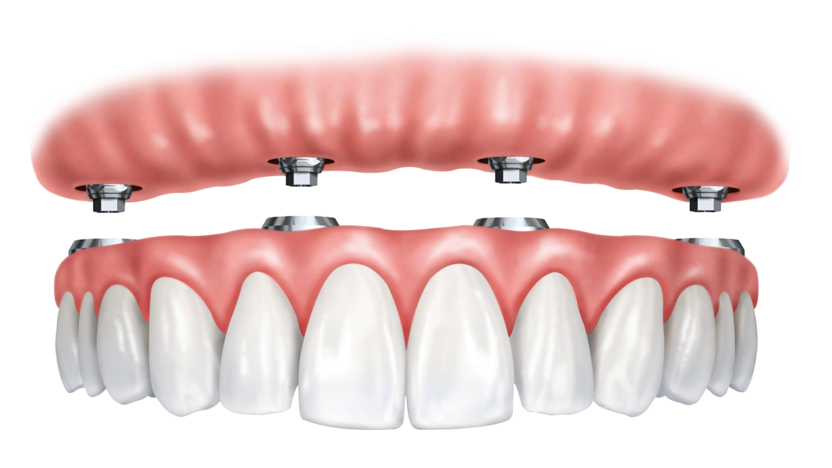 protocolo dentário na Allegra Odontologia