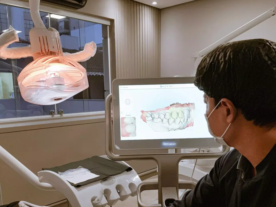 Scanner Itero na Allegra Odontologia - Estética dental perto do Brooklyn em SP