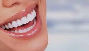 Clareamento dental no Tatuapé