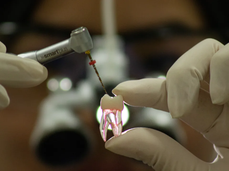 Tratamento de canal na Allegra Odontologia