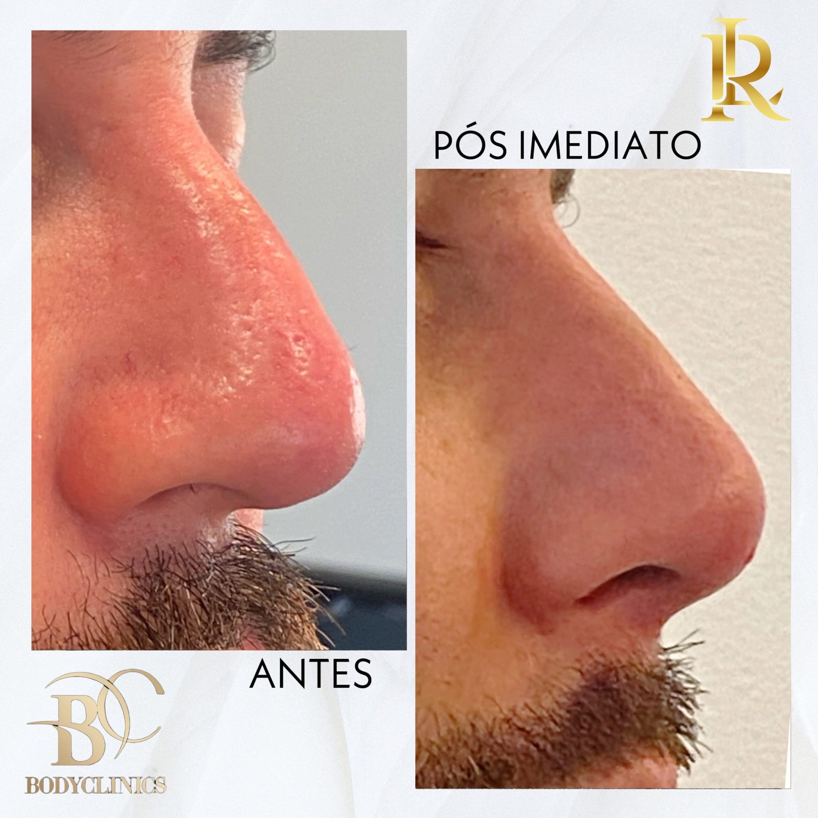 Harmonização Facial na Allegra Odontologia