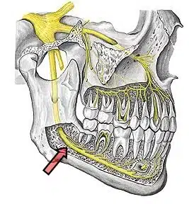 Nervo Alveolar Inferior