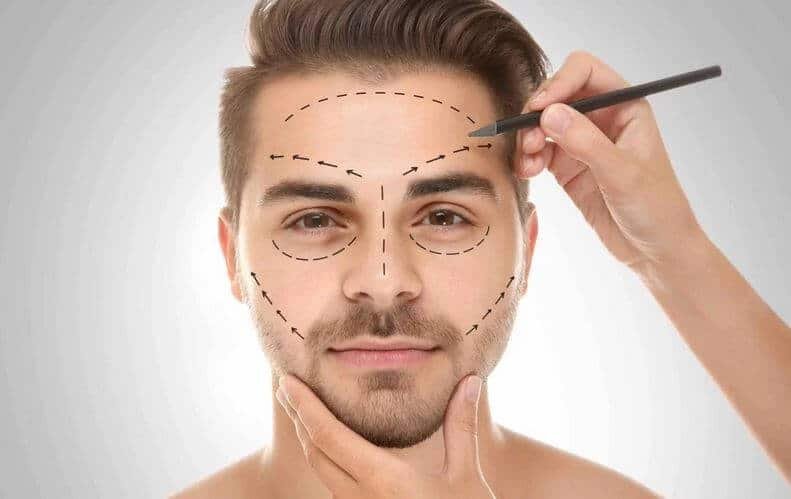 Homem recebendo marcações no rosto para planejamento de harmonização facial masculina.