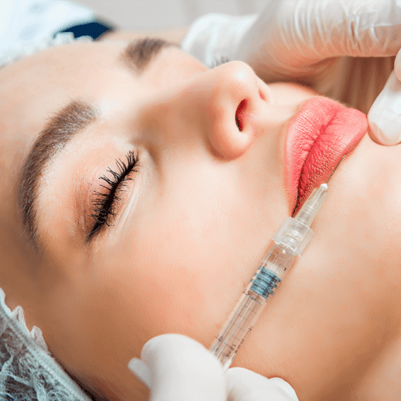 Mulher recebendo preenchimento facial no Tatuapé com ácido hialurônico na clínica Allegra Odontologia.