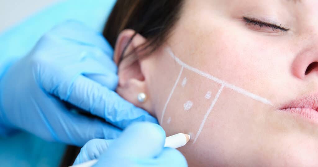 Paciente recebendo Botox para Dor de Cabeça e Bruxismo em clínica especializada