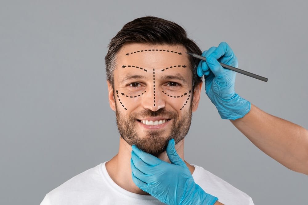 Paciente realizando procedimento de Harmonização Masculina em São Paulo na clínica Allegra Odontologia.