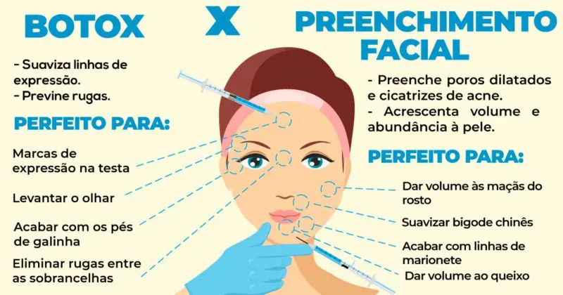 Aplicação de preenchimento facial premium com técnica avançada e toque delicado