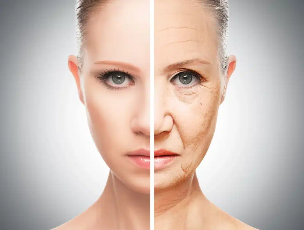 Antes e depois de paciente em tratamento de Harmonização Facial para Peles Sensíveis, com foco em rejuvenescimento natural e seguro.