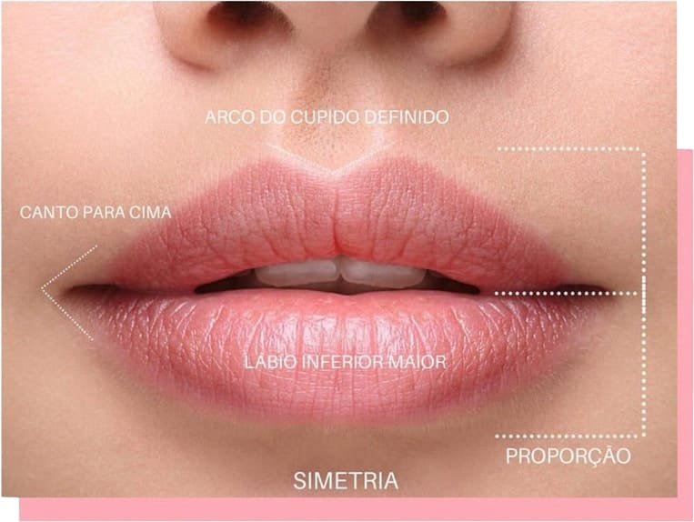 Simetria e proporção no Preenchimento Labial no Tatuapé com foco em naturalidade e harmonia facial.