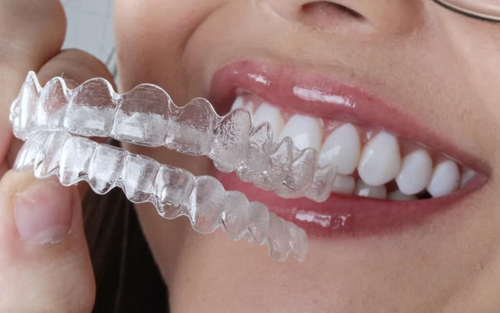Paciente em atendimento odontológico para implantes, clareamento e Invisalign em SP – Allegra Odontologia.