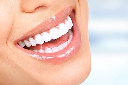 Sorriso feminino após clareamento dental realizado em SP na clínica Allegra Odontologia.